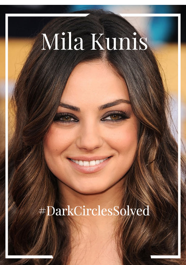 Even Mila Has Dark Undereye Circles! Fix Yours With This Product